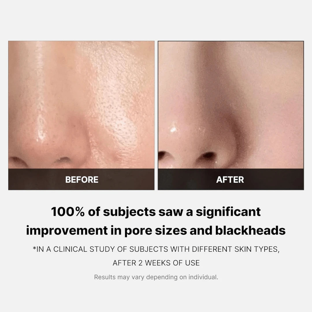 Zero Pore Pad