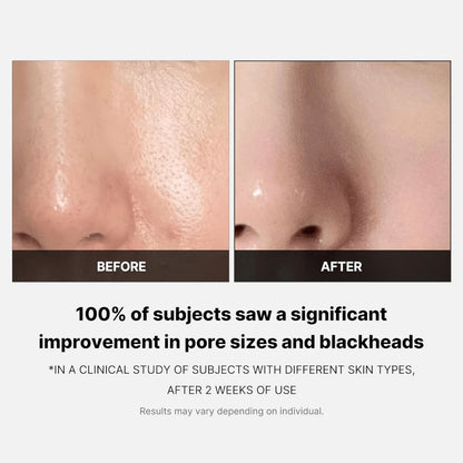 Zero Pore Pad